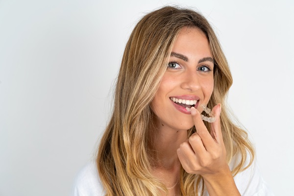 Clear Aligners From A General Dentist