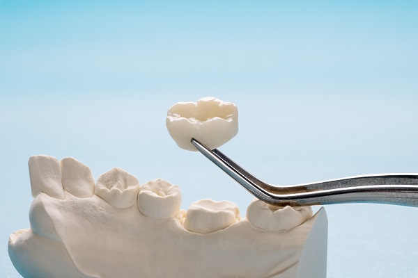 How Does A Dentist Prepare A Tooth For A Dental Crown?